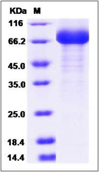SDS-PAGE analysis of human SIGLEC6 protein