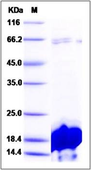 SDS-PAGE analysis of Human IBA1 protein (His Tag)