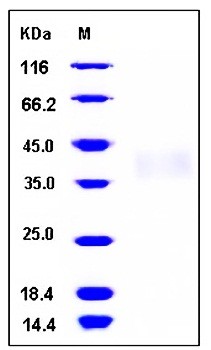 SDS-PAGE analysis of human TREM1 His tag protein