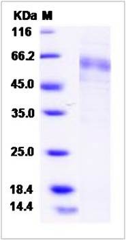 SDS-PAGE analysis of human DIRAS3 protein
