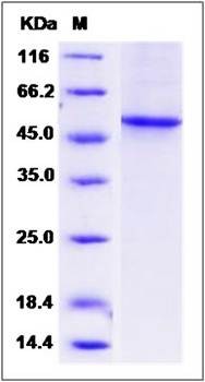 SDS-PAGE analysis of human CCNE1 protein
