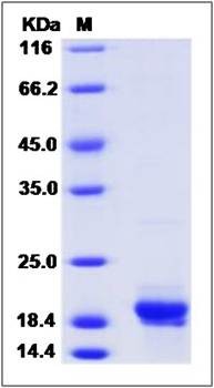 SDS-PAGE analysis of MDM4 (His Tag) protein