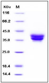SDS-PAGE analysis of human ESAM His tag protein
