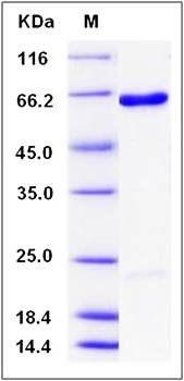 SDS-PAGE analysis of Human USP46 protein (N-SUMO)