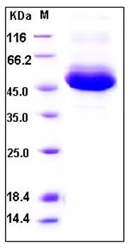 SDS-PAGE analysis of human CTSA His tag protein