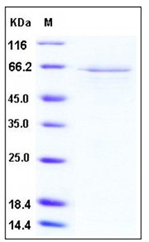 SDS-PAGE analysis of Human PRMT1 GST tag protein