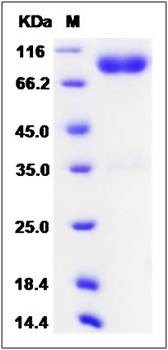 SDS-PAGE analysis of Mouse IL1R2 protein
