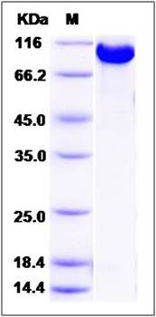 SDS-PAGE analysis of human RRM1 protein (GST Tag)