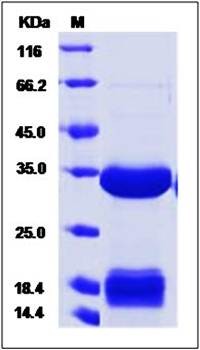 SDS-PAGE analysis of human CA4 protein (His Tag)