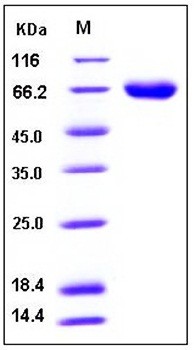 SDS-PAGE analysis of Mouse KIRREL1 His tag protein