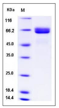 SDS-PAGE analysis of human ALPI protein (His Tag)