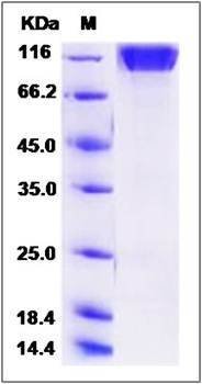 SDS-PAGE analysis of human SEZ6L2 protein (His Tag)