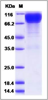 SDS-PAGE analysis of Cynomolgus IL17RA protein