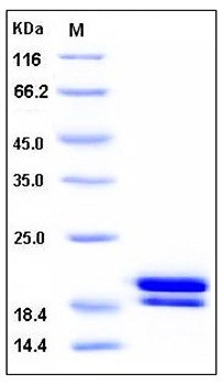 SDS-PAGE analysis of Human REG1B His tag protein