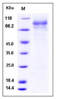SDS-PAGE analysis of Human IDS protein (His Tag)