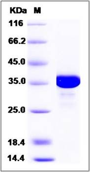 SDS-PAGE analysis of human AKR1C2 protein (His Tag)