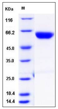 SDS-PAGE analysis of mouse CPB2 protein (His Tag)