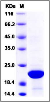 SDS-PAGE analysis of human DCTPP1 protein (His Tag)