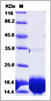 SDS-PAGE analysis of Human PVALB protein (His Tag)