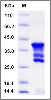 SDS-PAGE analysis of human CD247 protein (GST Tag)
