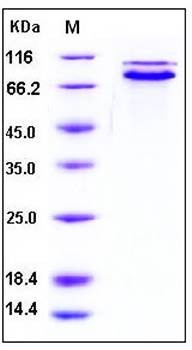 SDS-PAGE analysis of human CDH1 His tag protein