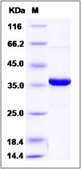 SDS-PAGE analysis of Human PTPN2 protein