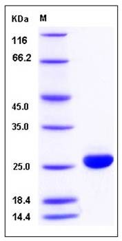 SDS-PAGE analysis of human BLVRB protein (His Tag)