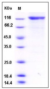 SDS-PAGE analysis of human TLK1 His GST tag protein
