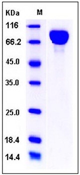 SDS-PAGE analysis of Mouse IL6ST His tag protein