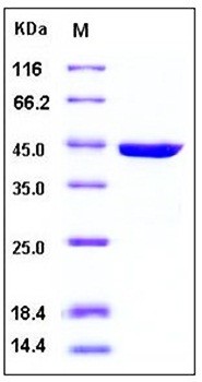 SDS-PAGE analysis of Human RAC1 GST tag protein