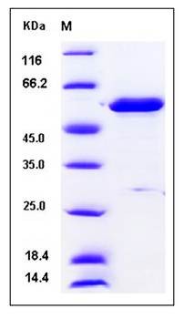 SDS-PAGE analysis of Human PHGDH protein (His Tag)
