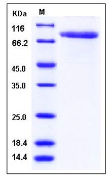 SDS-PAGE analysis of human TFRC His tag protein
