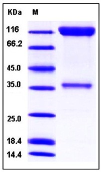 SDS-PAGE analysis of Human PDGFRB Fc His tag protein