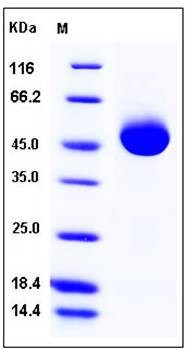 SDS-PAGE analysis of human ACPP His tag protein