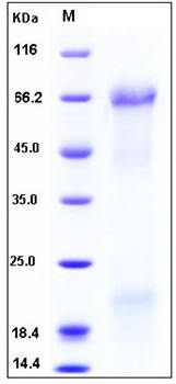 SDS-PAGE analysis of human Spp1 His tag protein