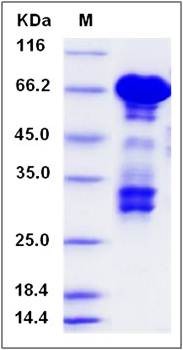 SDS-PAGE analysis of Human PARVA protein (GST Tag)