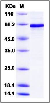 SDS-PAGE analysis of Human PDHA1 protein (GST Tag)