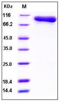 SDS-PAGE analysis of human C2 His tag protein