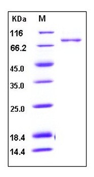 SDS-PAGE analysis of Human POSTN His tag protein
