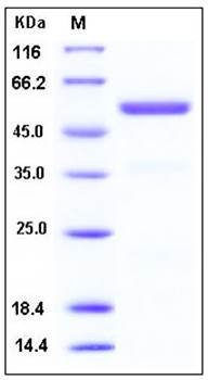 SDS-PAGE analysis of human CPE His tag protein