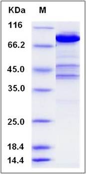 SDS-PAGE analysis of human Ezrin protein (His Tag)