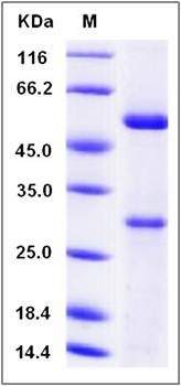 SDS-PAGE analysis of Human MFAP5 protein (His Tag)