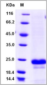 SDS-PAGE analysis of human CD20 protein (His Tag)