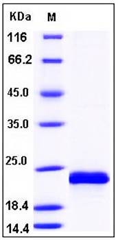 SDS-PAGE analysis of Human HRAS His tag protein