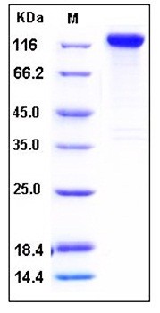 SDS-PAGE analysis of human SLITRK1 Fc His tag protein