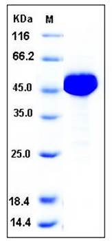 SDS-PAGE analysis of human ALDH1A1 His tag protein