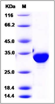 SDS-PAGE analysis of Human NQO1 protein (His Tag)