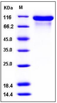 SDS-PAGE analysis of human ErbB3 His tag protein