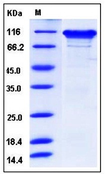 SDS-PAGE analysis of Human NLGN3 His tag protein