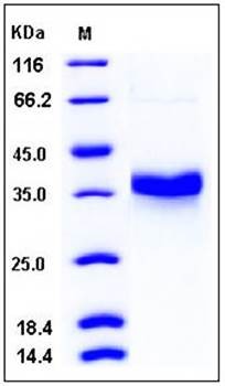 SDS-PAGE analysis of human FOLR1 His tag protein